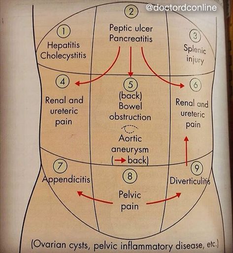 doctordconline: “Quadrants of Abdomen and associated disorders. Pic from Shortcourse Of Surgery, Love & Bailey.📷 @soookhi #abdomen #surgery #surgeon #usmle #usmlestep1 #usmlestep2 #doctor... Gi Nursing, Paramedic Study, Pass Nursing School, Pelvic Inflammatory, Nhs Nurse, Doctor Stuff, Emt Study, Hospital Patient, Lung Detox