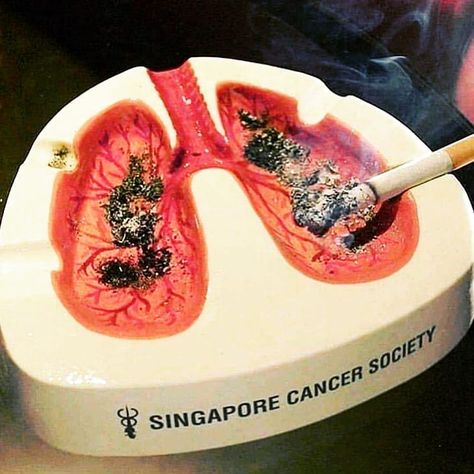 Advertising Advocates on Instagram: “This design shows you how your lung will look after smoking! #SingaporeCancerSociety #AdvertisingAdvocates” Sculpture Art Clay, Tanah Liat, Clay Diy Projects, Apollo Box, Puff And Pass, Clay Art Projects, Art Clay, Ceramics Ideas Pottery, Diy Clay Crafts