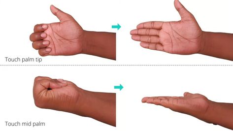 5 Easy Dupuytren's Contracture Exercises for Finger Pain Relief 4 Dupuytren's Contracture, Routine Ideas, Hand Therapy, Medical Information, Daily Routine, Pain Relief, Disease, Medical, Health