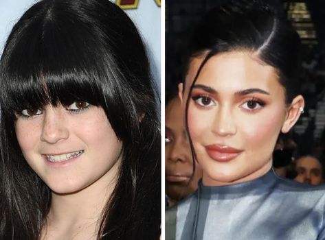 Pop Archive (@pop_archives) on X Celebrities Before And After, Plastic Surgery, Kendall Jenner, Kylie Jenner, Then And Now, Surgery, Thread, Celebrities