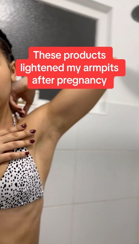 If you're experiencing the sudden and uncomfortable darkening of your underarms during pregnancy, you're not alone. Fortunately, we have a solution for you! Learn how to lighten dark underarms fast and effectively, with our all-natural, pregnancy-safe skincare tips. Say goodbye to hyperpigmentation and hello to a lighter, brighter armpit area. 🌿✨ Turmeric For Dark Underarms, How To Lighten Dark Underarms, Underarm Darkness Remedies, How To Lighten Armpits, Armpit Lightening, Underarm Darkness, Body Acne Remedies, Skin Lightening Products, Hyperpigmentation Remedies