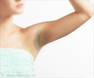 Want to get rid of dark underarms or dark armpits? Here are some natural remedies you can try out at home. Wearing of dark-colored clothes, hair removal creams, excessive usage of deodorants or perfumes all cause dark underarms. Remedies For Dark Underarms, Rid Of Dark Underarms, For Dark Underarms, Armpit Rash, Black Armpits, Armpit Whitening, Upper Lip Hair, Dark Armpits, Body Tips