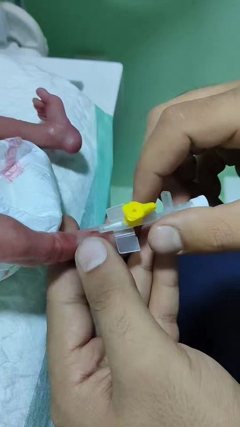 How to insert pediatric IV cannula ..... | Nursing Students | Eldfell · The Sweetest Air Iv Cannula, Nursing Students, Pediatrics, Nursing