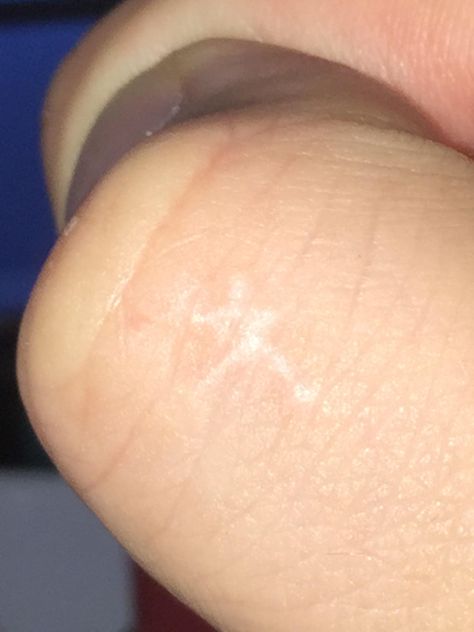 My birthmark on my thumb looks a little like the Blair Witch Project symbol. Witch Birthmarks, The Blair Witch Project, Blair Witch Project, Blair Witch, Witch Magic, Workout Pictures, Healthy Living Lifestyle, Witch, Photography