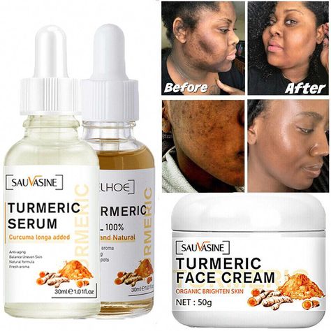 Find many great new & used options and get the best deals for Turmeric Serum Dark Spot Corrector Serum Skin Melasma Remove Turmeric Cream US at the best online prices at eBay! Free shipping for many products! Turmeric Serum, Dark Spot Corrector Serum, Turmeric Cream, Lemon On Face, Organic Face Cream, Lighten Skin Tone, Turmeric Oil, Bath Body Works Candles, Turmeric Extract