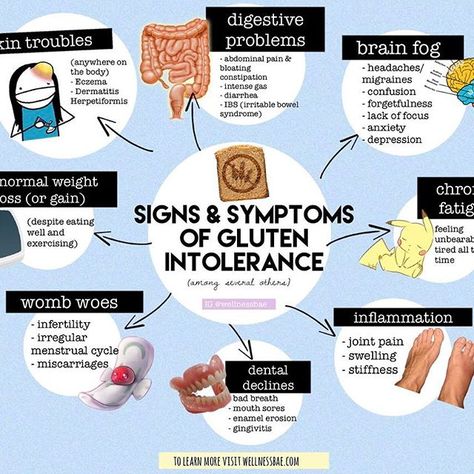 Fun fact: the term 'koiliakos' was coined about 2,000 years ago by the Greek physician Aretaeus to describe "suffering of the bowels", the word eventually became "celiac". Gluten-free diets are just for people with Celiac Disease! . .  I myself am gluten intolerant, which means that I present with the some of the signs and symptoms, but do not test positive for the specific markers of the disease. Finding this information out and taking it seriously changed my life. I was sick for years, overwei Lower Back Pain Exercises, Sciatic Nerve Pain, Irritable Bowel, Gluten Sensitivity, Gluten Intolerance, Oral Health Care, Keeping Healthy, Abdominal Pain, Nerve Pain