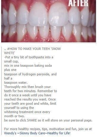 White Teeth Tips, Best Teeth Whitening Kit, Teeth Whitening Homemade, Teeth Whitening Remedies, Teeth Whitening Diy, Nice Teeth, Best Teeth Whitening, Natural Teeth Whitening, Natural Teeth