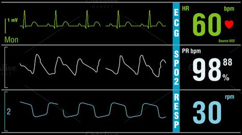 Patient monitor displays medical exam vital signs by HighRes Pictures on @creativework247 Vital Signs Monitor, Patient Monitor, Health Heart, Bowie Art, Medical Examination, Vital Signs, Pharmacist, Video Footage, Ultra Hd