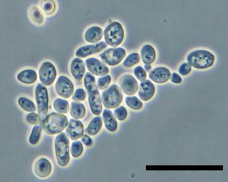 Kids science project: yeast cells under microscope. http://blog.microscopeworld.com/2014/05/kids-science-microscope-activity-yeast.html Preschool Microscope Activities, Microscope Experiments, Cells Under Microscope, Microscope Activity, Science Microscope, Bio Project, Homeschooling Science, Homeschool Science Experiments, Stem Camp