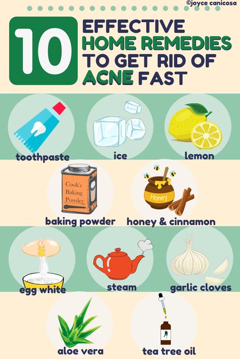 how to stop acne face care face diy acne diy facemask for acne acne hacks how to clear up acne facial acne natural acne acne facials diy foods that clear acne how to clear acne facials for acne diy acne mask facial care for acne How To Stop Acne, Acne Clearing Foods, Get Rid Of Acne Fast, Back Acne Remedies, Acne Hacks, Face Diy, Acne Medicine, Diy Foods, Bad Acne