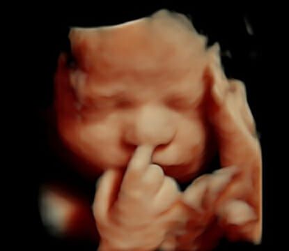 3d Ultrasound, 4d Ultrasound, Pregnancy Ultrasound, Gender Prediction, Baby Ultrasound, Beautiful Features, Ultrasound Pictures, Baby Scan, Unborn Baby