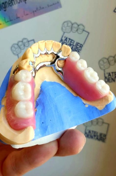 #artificialteeth #toothmissing Gum Surgery, Water Pick, Gum Inflammation, Swollen Gum, Partial Dentures, Dental Technician, Dental Laboratory, Receding Gums, Dentures