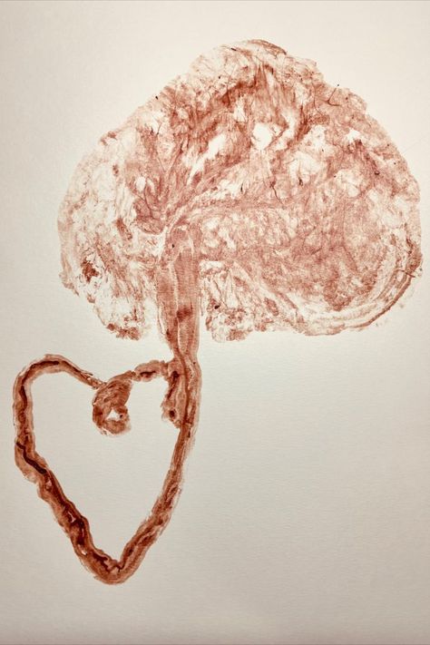 print of placenta and umbilical cord in heart shape Placenta Print, Placenta Art, Placenta Pills, Baby Hospital Photos, Container Project, Mother Tree, Birth Prep, Fall River Massachusetts, Placenta Encapsulation