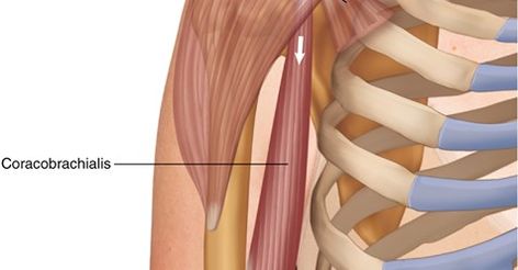 #Coracobrachialis_muscle is one of the three #muscles that originates from to the #coracoid process of the #scapula. It is situated at the #superomedial part of the #humerus. #Apex of the #coracoid_process, in between the #pectoralis_minor and short head of #biceps_brachii_muscle. #lesser_tubercle #Brachial_artery #Musculocutaneous_nerve #adducts #humerus #flexes #glenohumeral_joint #slender_muscle #muscles_anatomy Coracobrachialis Muscle, Musculocutaneous Nerve, Brachial Artery, Biceps Brachii Muscle, Muscles Anatomy, Biceps Brachii, Nerve, Muscles, Anatomy