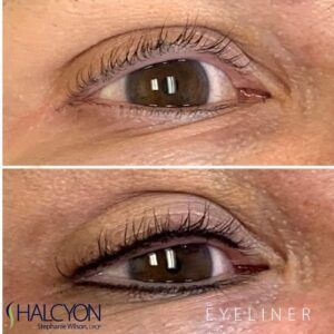 Eyeliner Tattoo Permanent Before And After, Permanent Eyeliner Before And After, Eyeliner Tattoo Permanent, Tatoo Eyeliner, Paramedical Tattoo, Permanent Makeup Removal, Permanent Makeup Studio, Tattoo Eyeliner, Permanente Make-up