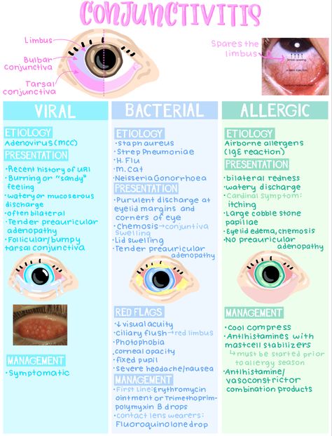 Opthalmic Technician Aesthetic, Optometry Notes, Ophthalmology Notes, Medical Study Notes, Opthalmic Technician, Ophthalmic Technician, Optician Training, Eye Health Facts, Optometry Education