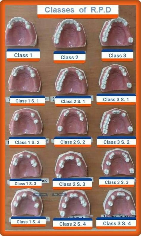 Scaling Teeth, Toothache Remedies, Dental Hygienist School, Dental Animation, Smile Club, Hygiene School, Dental Assistant Study, Dentist Assistant, Dental Hygiene Student