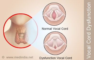 Vocal Cord Dysfunction - What is it? - Colorado Allergy & Asthma Centers, P.C. Vocal Cord Dysfunction, Vocal Tips, Voice Therapy, Vocal Cords, Medical Binder, Vocal Lessons, Asthma Inhaler, Allergy Asthma, Psychology Disorders