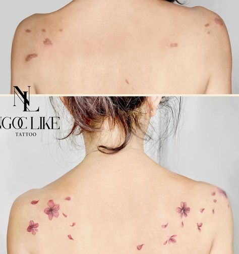 Tattoos Around Birthmarks, Acne Scar Tattoo Coverup, Birthmark Cover Up Tattoo, Keloids Tattoo Cover Up, Scar Tattoos Women, Wound Tattoo, Thigh Tats, Tattoo Scar, Orange Tattoo