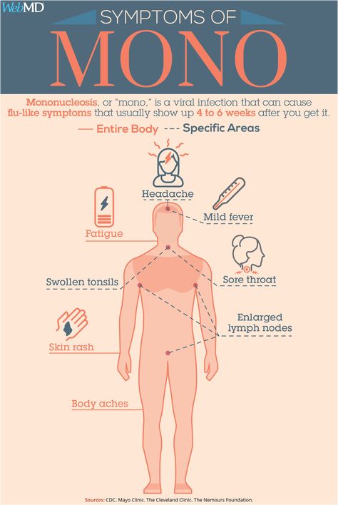 Kissing Disease, Germ Illustration, Plasma Donation, Swollen Tonsils, Medical Things, Epstein Barr, General Medicine, Autoimmune Disorders, Natural Antibiotic