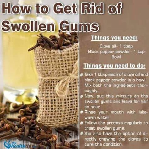 Home remedy for swollen gums.
#swollengums #swollengumsremedy Swollen Gums Inflammation, Swollen Gums Remedy, Natural Remedies For Acne, Fast Food Diet, Home Made Remedies, Swollen Gum, Remedies For Acne, Heal Thyself, Natural Acne Remedies