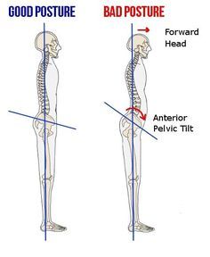 Did you know that your stomach pouch could be coming from a tilted pelvis? #fitness #health Hip Flexor Pain, Back Spasm, Psoas Release, Posture Fix, Hip Problems, Pelvic Tilt, Tight Hip Flexors, Hip Flexor Stretch, Belly Pooch