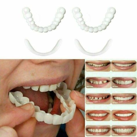 Snap On False Teeth Upper & Lower Dental Veneers Dentures Tooth Teeth Cover Set | eBay Gapped Teeth, Teeth Covers, Veneers Teeth, Fake Teeth, False Teeth, Perfect Teeth, Dental Veneers, The Teeth, Dental Cosmetics