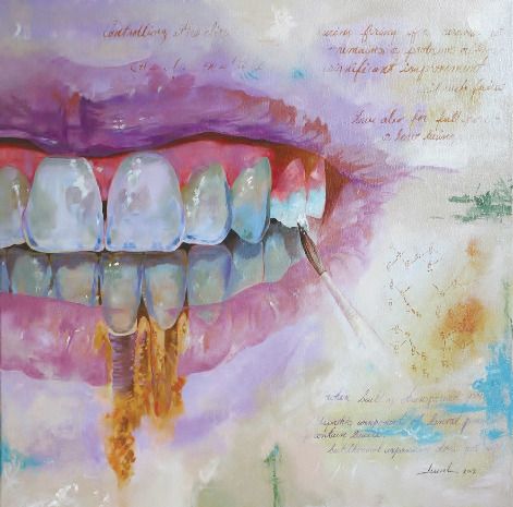 Before emigrating from Cuba, studying dental technology and becoming the owner of MardentProsthetics Dental Lab in Miami, Marcel Fundora was a painter; his artwork appeared in exhibits in New York, Miami... Dentist Cartoon, Dental Ceramics, Dental Pictures, Dentist Art, Dental Images, Tooth Care, Dental Videos, Dental Photography, Teeth Art