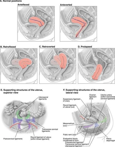 Positions of the uterus Ultrasound Anatomy, Abdomen Ultrasound, Gyn Ultrasound, Retroverted Uterus, Fetal Ultrasound, Diagnostic Medical Sonography Student, Ultrasound School, Obstetric Ultrasound, Sonography Student