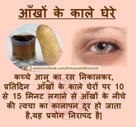 Natural Skin Care Remedies, Natural Health Care, Home Health Remedies, Health And Fitness Articles, Daily Health Tips, Natural Health Tips, Beauty Remedies, Health Knowledge, Health Skin Care