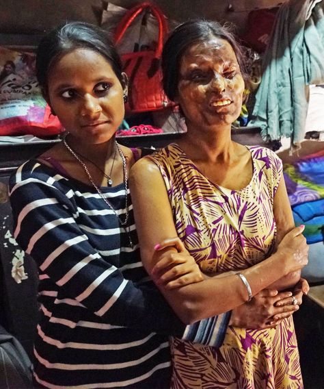 How one woman found solace after being attacked by her father Cafe India, Acid Attack, Women Survivor, Some Nights, Heavy Heart, Yahoo News, Come Home, Faith In Humanity, Girl Names