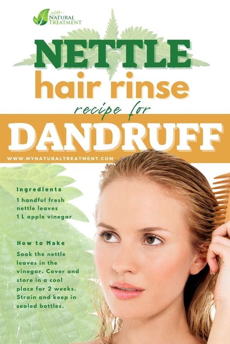 Home Remedy For Dandruff, Nettle For Hair, Hair Rinse Diy, Hair Rinse Recipe, Natural Dandruff Remedy, Hair Mask For Dandruff, Home Remedies For Dandruff, Dandruff Remedy, Homemade Hair Mask