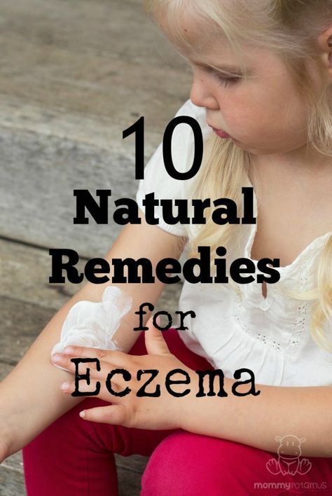 natural-remedies-eczema Natural Healing Remedies, Natural Cough Remedies, Cough Remedies, Text Overlay, Natural Home Remedies, Natural Treatments, Vitamin D, Health Remedies, Herbal Remedies