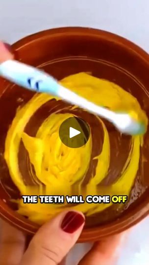 5.3K views · 272 reactions | Sharing to you the natural recipe to remove tartar and whitens the teeth in just 1 minute only...watch to discover! | By Ruel Ilagan | Facebook Tartar Teeth, Baby Tooth Decay, Tartar Removal, Tooth Decay Remedies, Tooth Whitening, The Teeth, Natural Teeth, Oral Health Care, Tooth Decay