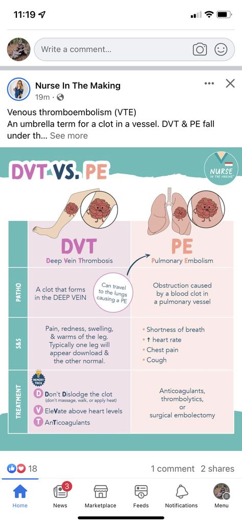 Nurse Study Notes Fundamentals, Dvt Nursing, Pathophysiology Nursing Notes, Medical Pneumonics, Lpn School, Nursing Pathophysiology, Nurse In The Making, Apical Pulse Location, Ob Nursing Student Cheat Sheets