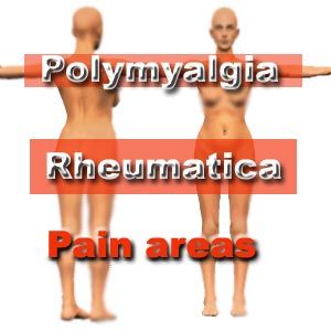 Pmr Autoimmune Disease, Polymalagia Rheumatica, Chronic Fatigue Diet, Rh Negative, Occipital Neuralgia, Musculoskeletal Pain, Knee Replacement, Rare Disease, Balanced Life