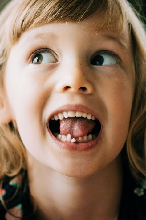 What Do I Do If My Kid Swallowed a Baby Tooth? Loose Teeth, Dentist Art, Dental Advertising, Kids Cough, Chipped Tooth, Dental Aesthetics, Dental Photography, Kids Dentist, Kids Teeth