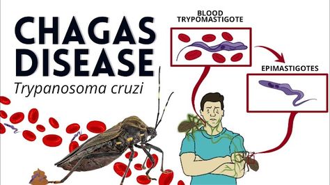 Don't Let the Kissing Bug Bite: Understanding Chagas Disease - Parasitology Microbiologist Doctor_dr2021 Kissing Bug, Bug Bite, Bug Bites, Don't Let, Bugs, Disease, Kiss, Science, Let It Be