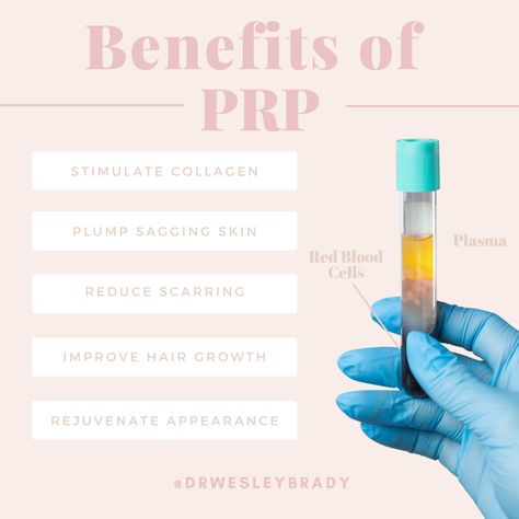 Vampire Facial Benefits, Prp Aesthetics, Prp Benefits, Prp Facial, Plasma Facial, Health Benefits Of Collagen, Facial Benefits, Treat Hyperpigmentation, Skin Anatomy