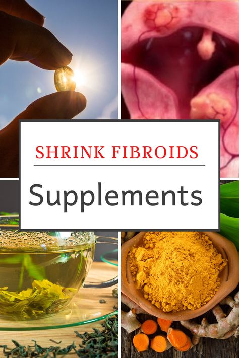 Discover herbs that help shrink and manage fibroids symptoms Uterine Fibroid Remedies, Best Herbs For Fibroid, Fibroid Shrinking Supplements, How To Shrink Fibroid Tumors, Fibroid Diet Shrink, Fibroid Diet, Anti Inflammation Recipes, Natural Health Tips, Inflammatory Foods