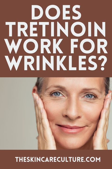 Tretinoin Before And After Wrinkles, Tretinoin Benefits, Tretinoin Before And After Anti Aging, Tretinoin Before And After, Lightening Underarms, Home Facial Treatments, Tretinoin Cream, Wrinkle Remedies, Pimples Remedies