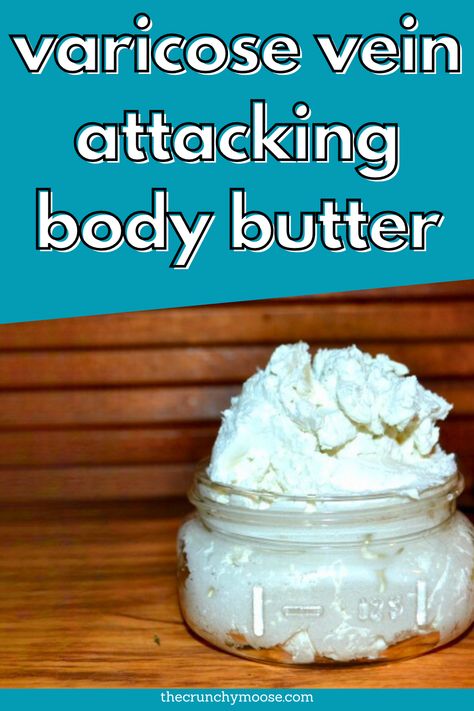 Yes, you can get rid of varicose veins naturally! No lasers needed. There are ways you can support blood flow, circulation, and healthy veins at home to prevent & reduce varicose veins.  How to support circulation and healthy veins naturally with homemade diy body butter / lotion with essential oils. Vericous Veins, Healthy Veins, Vein Health, Varicose Vein Removal, Varicose Vein Remedy, Diy Body Butter, Body Butters Recipe, Essential Oils Health, Natural Sleep Remedies