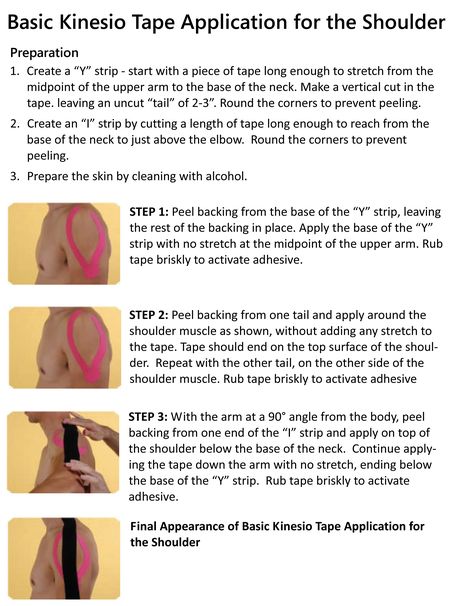 Basic Kinesio Tape Application for the Shoulder Kinesio Taping Shoulder, Physio Tape, K Tape, Kt Tape, Rotator Cuff Injury, Kinesio Taping, Sports Therapy, Kinesiology Taping, Rotator Cuff