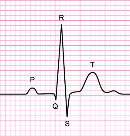 The Basics of ECG Interpretation (Part 3 – Waves, Segments & Intervals) Sinus Rhythm Tattoo, Ecg Tattoo, Medical School Interview, Normal Sinus Rhythm, Advanced Cardiac Life Support, Ecg Interpretation, Anatomical Heart Art, Atrial Fibrillation, Creative Wall Painting