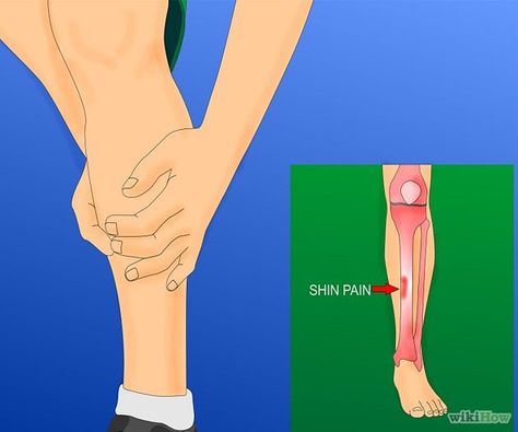 Shin Splints Stretches, Shin Splint Relief, Shin Splint Exercises, Half Marathon Training Plan, Workout Time, Marathon Training Plan, Shin Splints, Fit Girl Motivation, Half Marathon Training