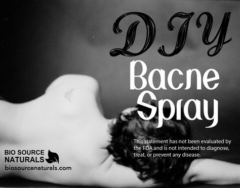 Bacne Spray, Back Acne Products, Essential Oil Diy, Oils Benefits, Back Acne Remedies, Chest Acne, Back Acne, Forehead Acne, Acne Products