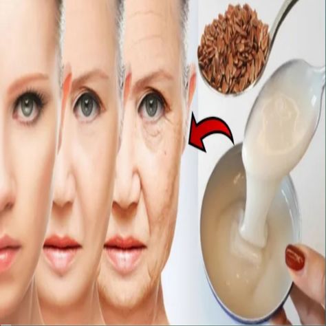 A DIY Natural Remedies - 70 years and looks 30 with this anti aging Botox for face lift/ wrinkle removal Diy Natural Remedies, Home Remedies For Wrinkles, Face Lift, Wrinkle Remover, Diy Natural Products, Diy Beauty, Home Remedies, Natural Remedies, Anti Aging