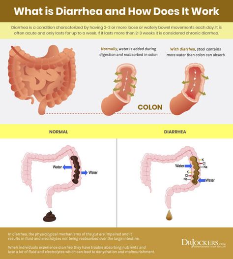 How To Get Rid Of Diaherra, How To Stop Diaherra, Diahrea Remedies, Ileocecal Valve, Healing Diet, Indigenous Education, Gut Issues, Low Stomach Acid, Fluid And Electrolytes