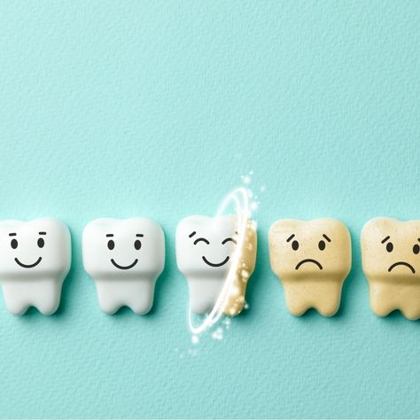 When the white, hard outer layer of enamel on your teeth is eroded away, it exposes the dentin beneath. Dentin is the yellow-ish tissue that makes up the core of each tooth. Yellow Teeth, Tooth Enamel, Wellness Routine, White Teeth, Healthy Teeth, Oral Hygiene, Beautiful Smile, Skin Color, The White