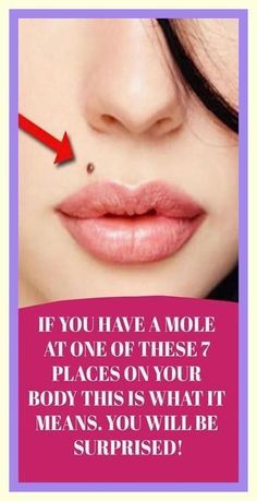 If You Have A Mole At One Of These 7 Places On Your Body, You Will Be Surprised What It Means! Mole Meaning, Moles On Face, Medicine Book, Natural Health Tips, Health Guide, Natural Treatments, Natural Medicine, Health Awareness, Herbal Medicine